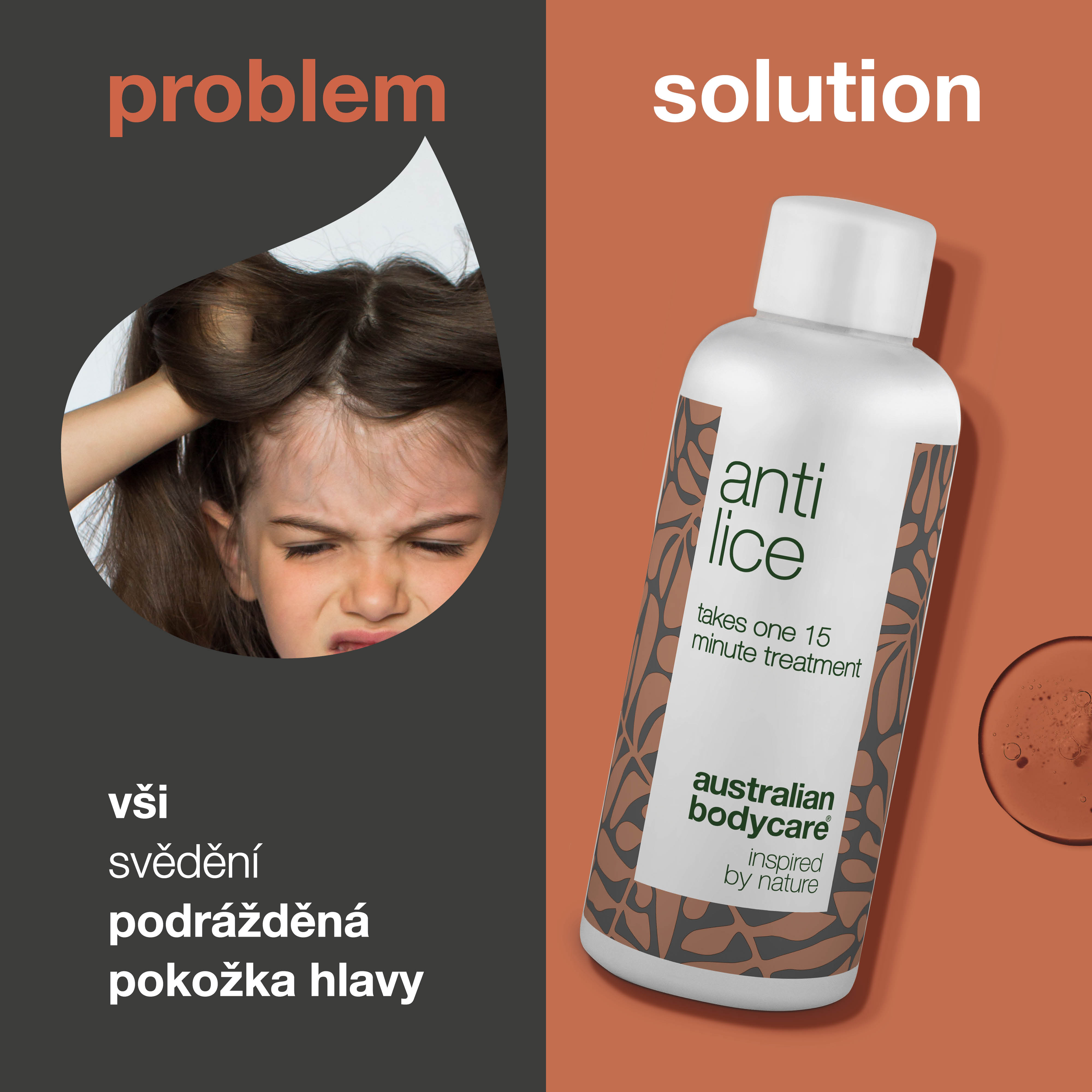 Leczenie wszy - Skuteczne leczenie przeciwko wszom i jajom w 15 minut - Nietoksyczne leczenie wszy na bazie naturalnych składników. Obudowuje i dusi wszy i jaja. Bez parabenów i środków owadobójczych.