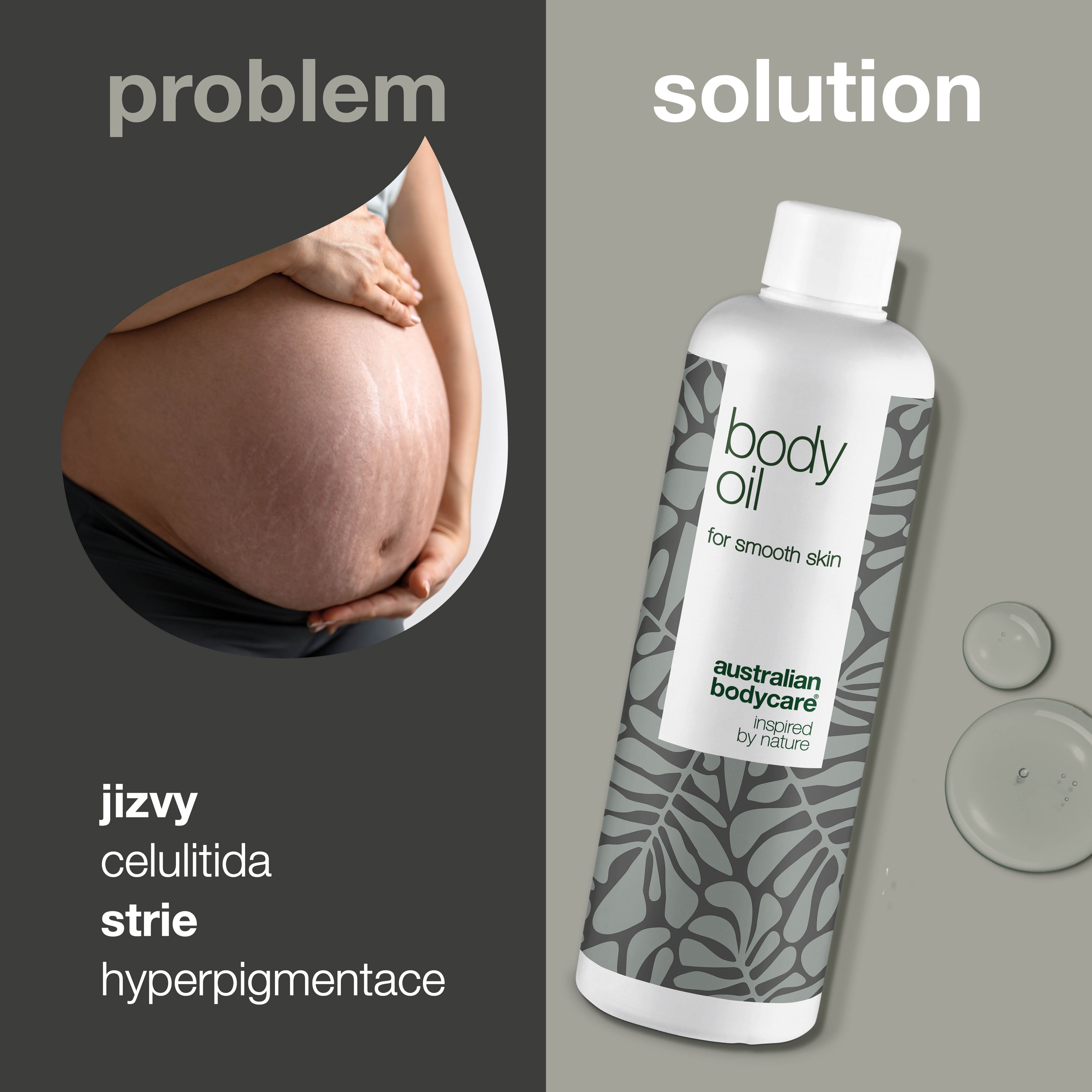 Body Oil – Snižuje strie, jizvy a pigmentové skvrny — Body Oil snižuje strie, jizvy a pigmentové skvrny. Obsahuje mandlový olej, skvalan a vitamín E pro hydratovanou a jemnou pokožku.