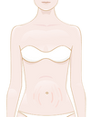 Jak snížit viditelnost strií na prsou