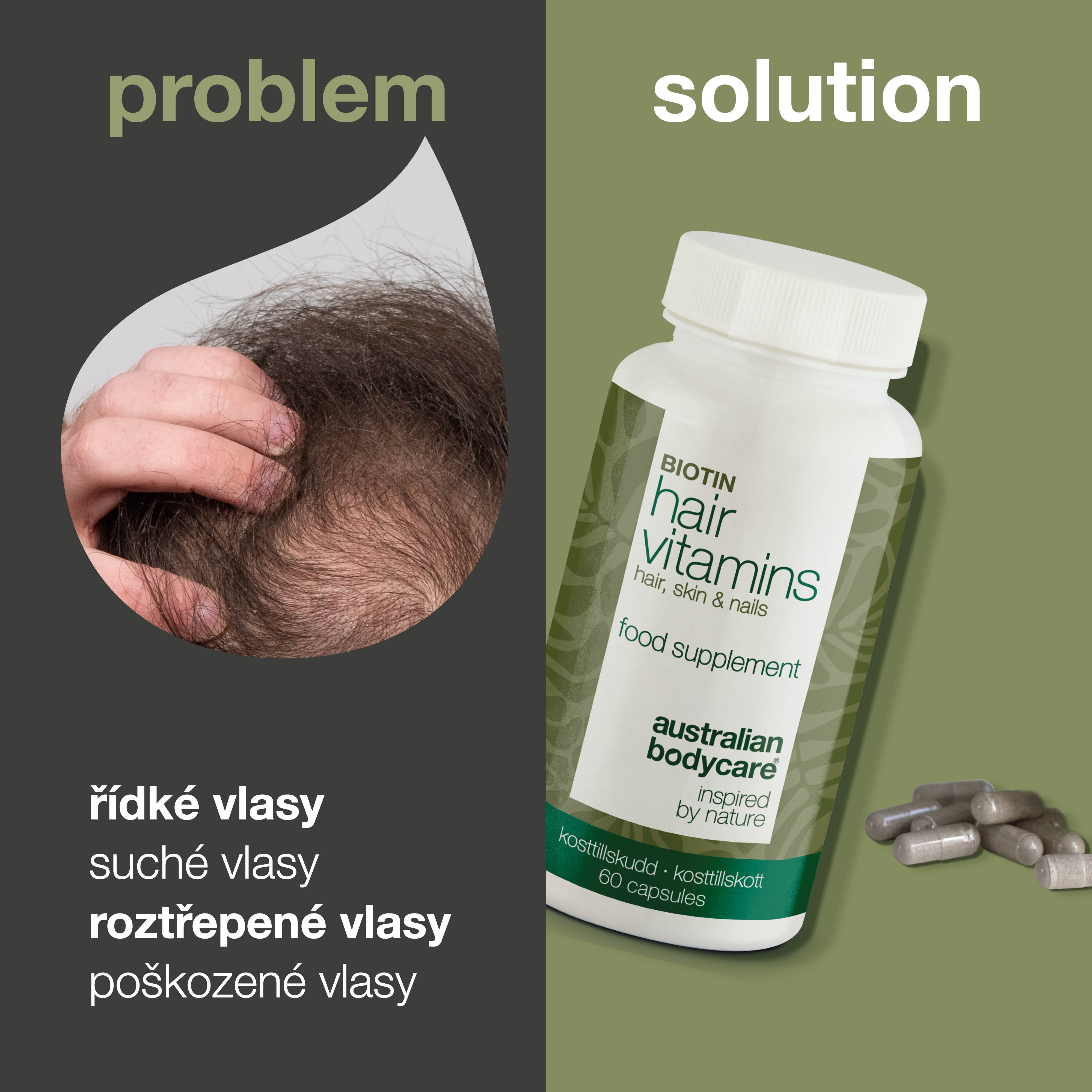 Vitamíny na vlasy s biotinem — Udržují zdravé vlasy a mohou být použity při vypadávání vlasů