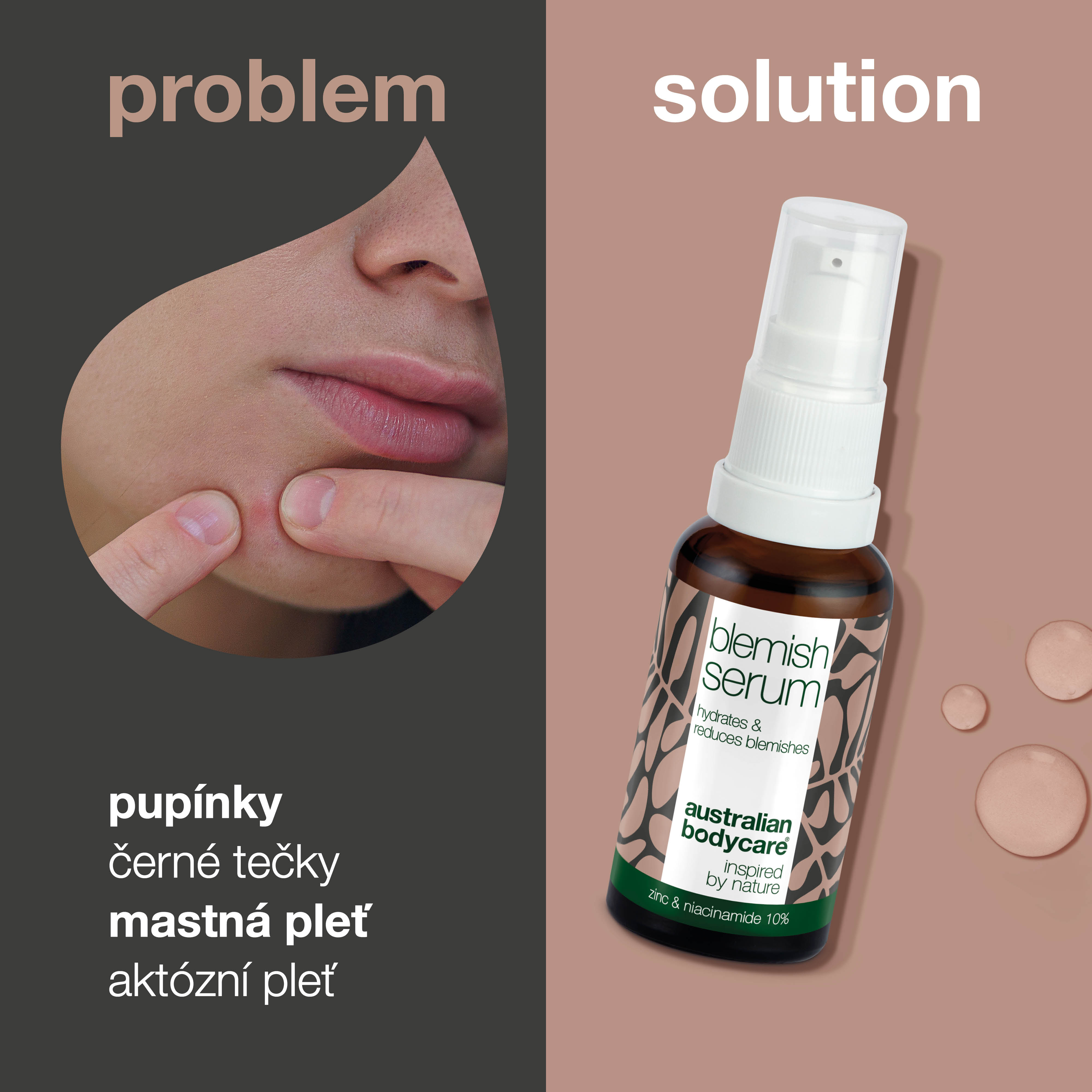 Serum z niacynamidem na pryszcze i zaskórniki - z 10% niacynamidem, 1% cynkiem i olejkiem z drzewa herbacianego na pryszcze, zaskórniki i wypryski