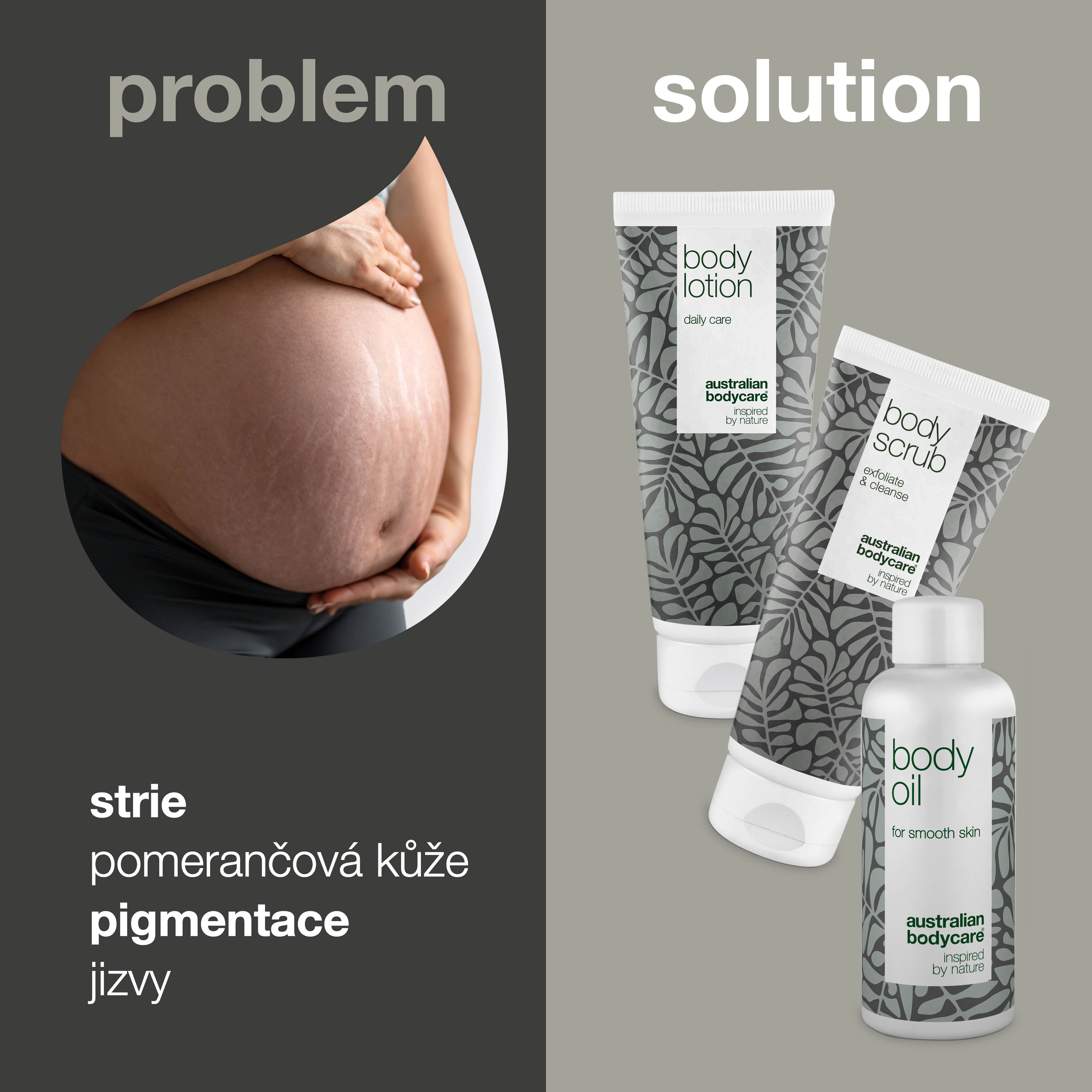 Stretch Mark Reduktor 3-pak — 3 produkty zmniejszające widoczność rozstępów i blizn