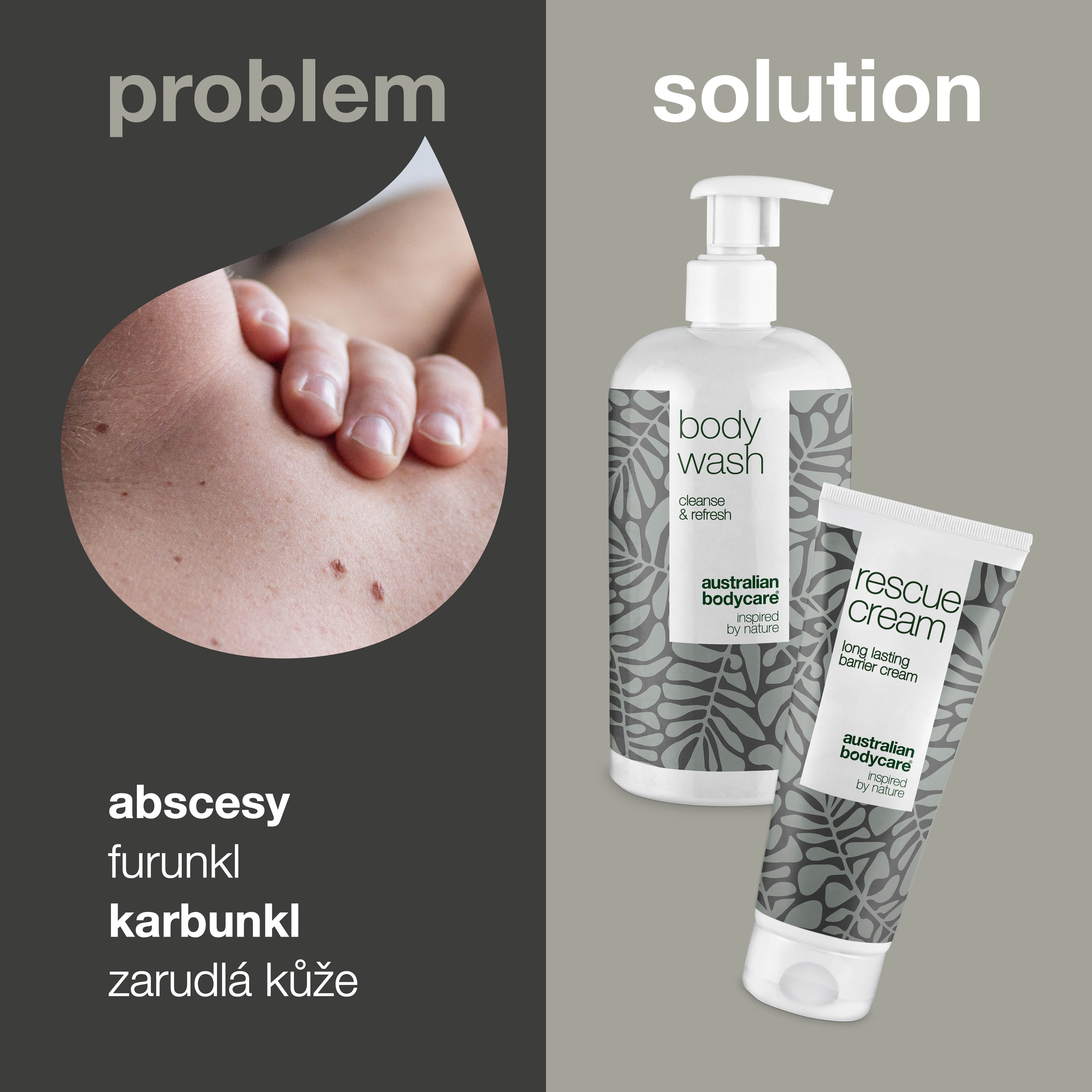Daily Boil Care Kit — 2 produkty do codziennego oczyszczania i leczenia czyraków, ropni i odsłoniętej skóry