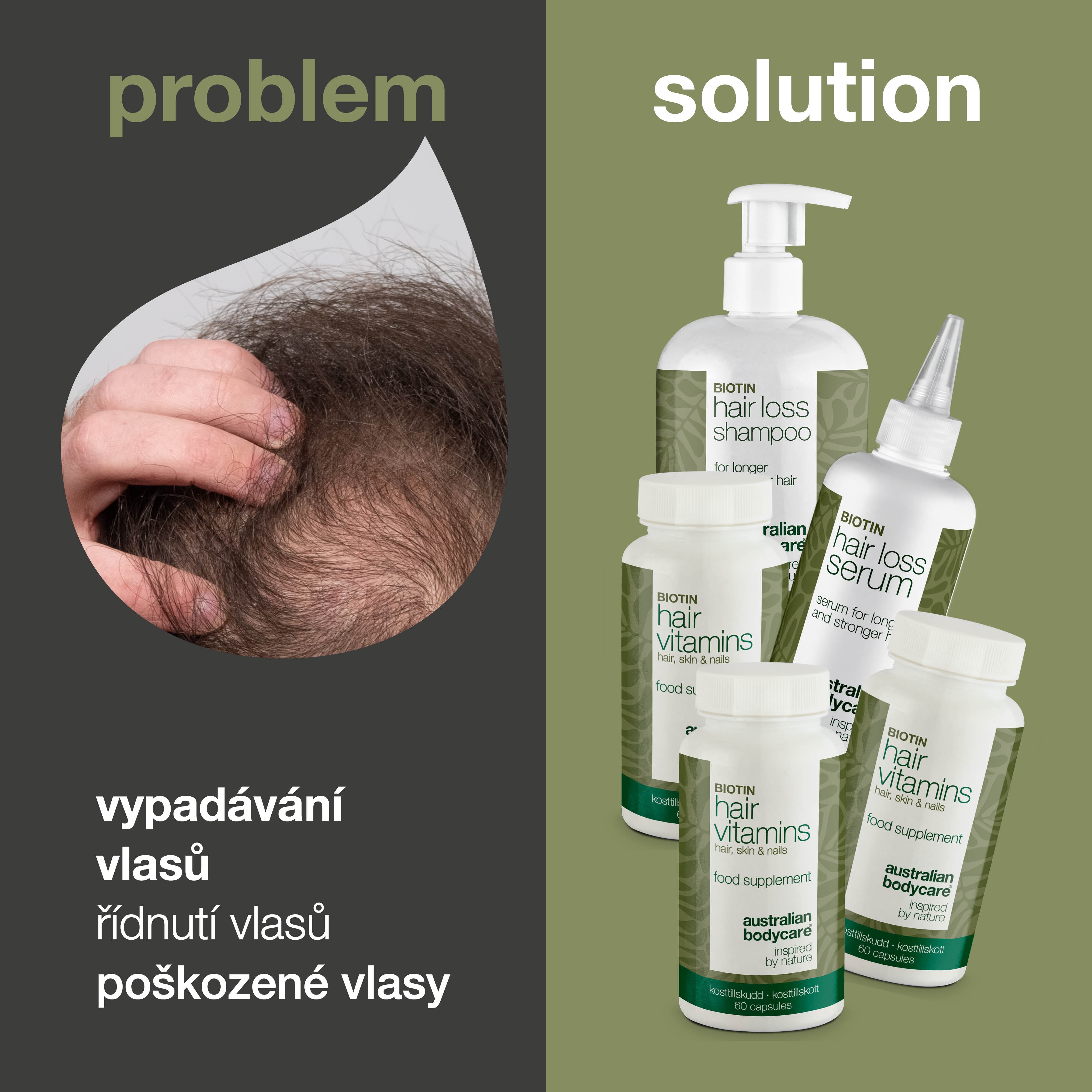 XL balíček proti vypadávání vlasů — 5 produktů proti vypadávání vlasů s biotinem pro řídnoucí vlasy