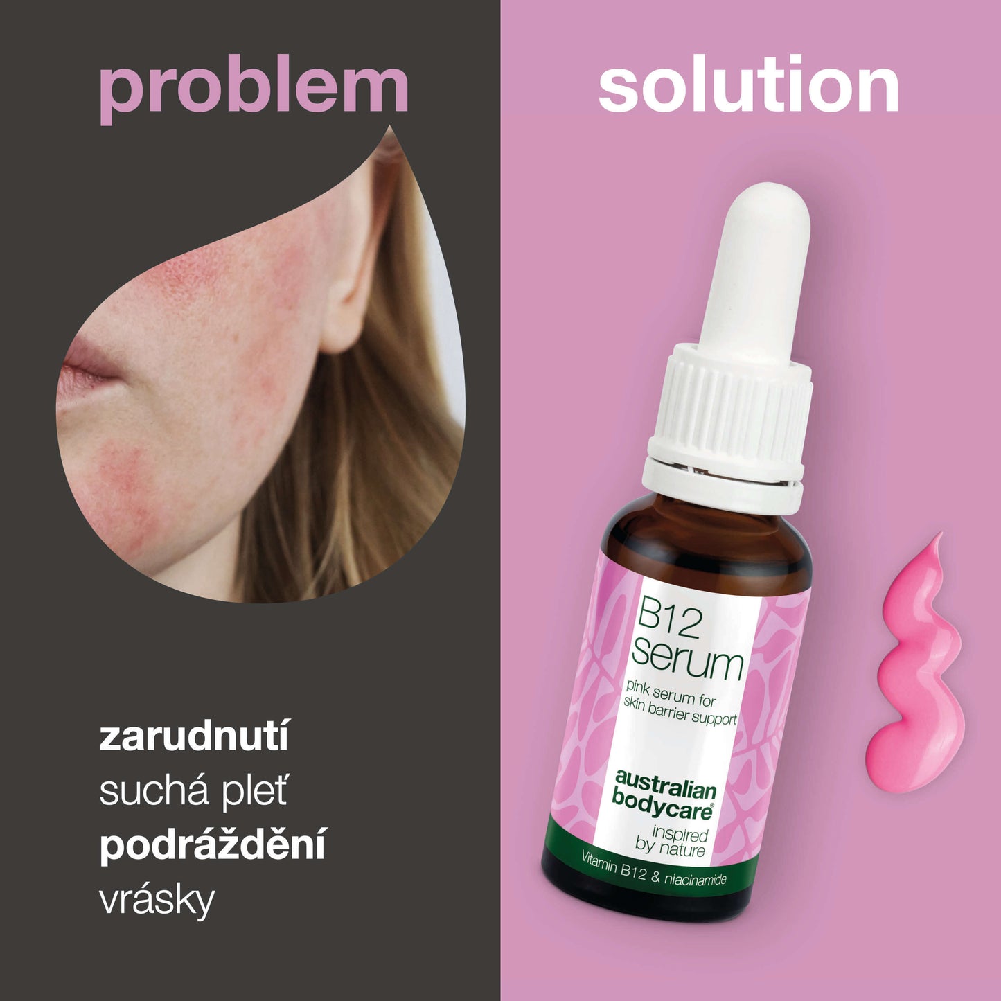 B12 Pink Sérum – Snižte zarudnutí a posilte kožní bariéru — B12 Pink Sérum snižuje zarudnutí a posiluje kožní bariéru. Ideální pro suchou a citlivou pleť. Zažijte zdravou a zářivou pokožku s přírodními ingrediencemi.