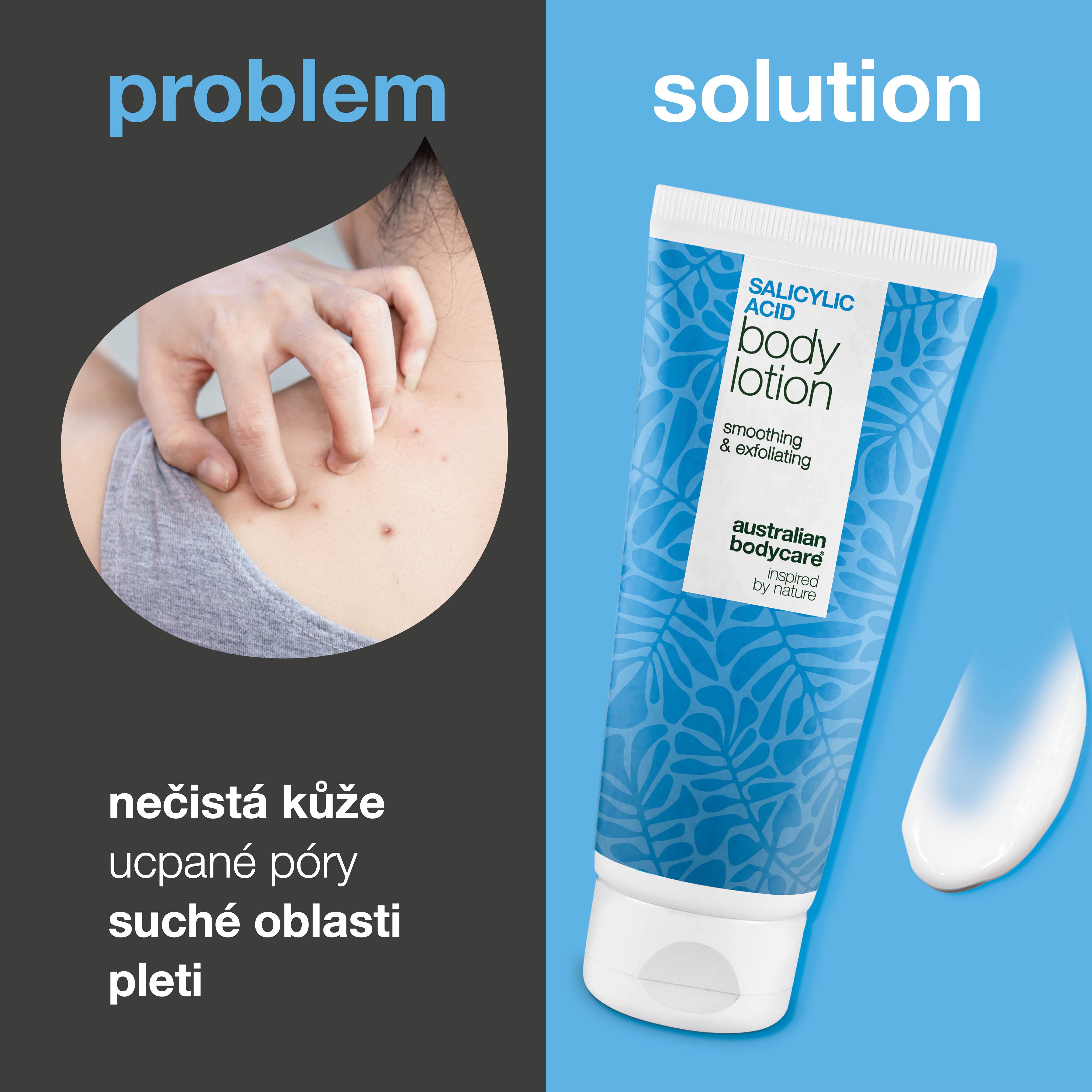 Tělové mléko s kyselina salicylová – suchá a hrubá pokožka — Tělové mléko s kyselina salicylová jemně exfoliuje, hydratuje a pomáhá vyhladit suchou a hrubou pokožku. Ideální pro každodenní péči.