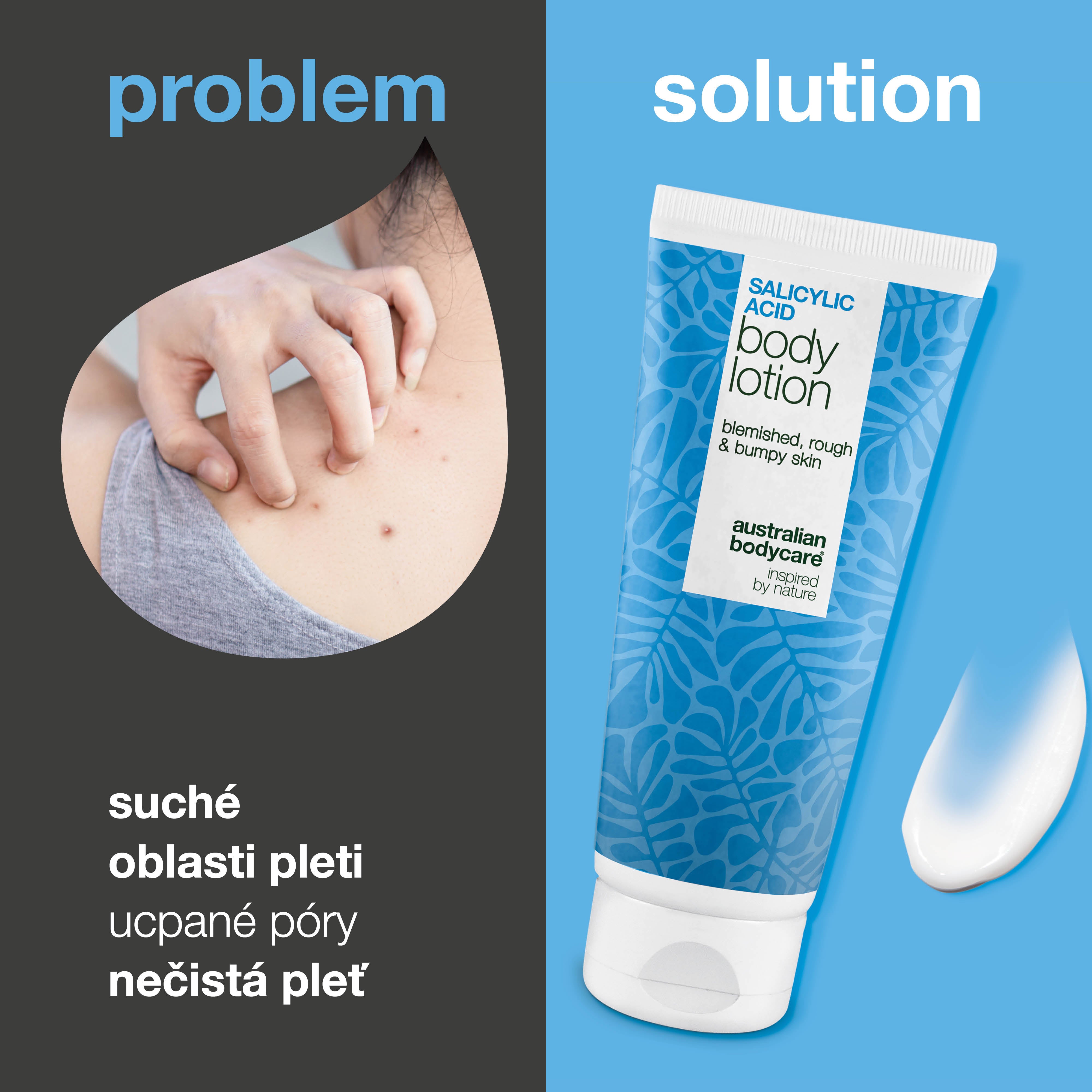 Tělové mléko s kyselina salicylová – suchá a hrubá pokožka — Tělové mléko s kyselina salicylová jemně exfoliuje, hydratuje a pomáhá vyhladit suchou a hrubou pokožku. Ideální pro každodenní péči.