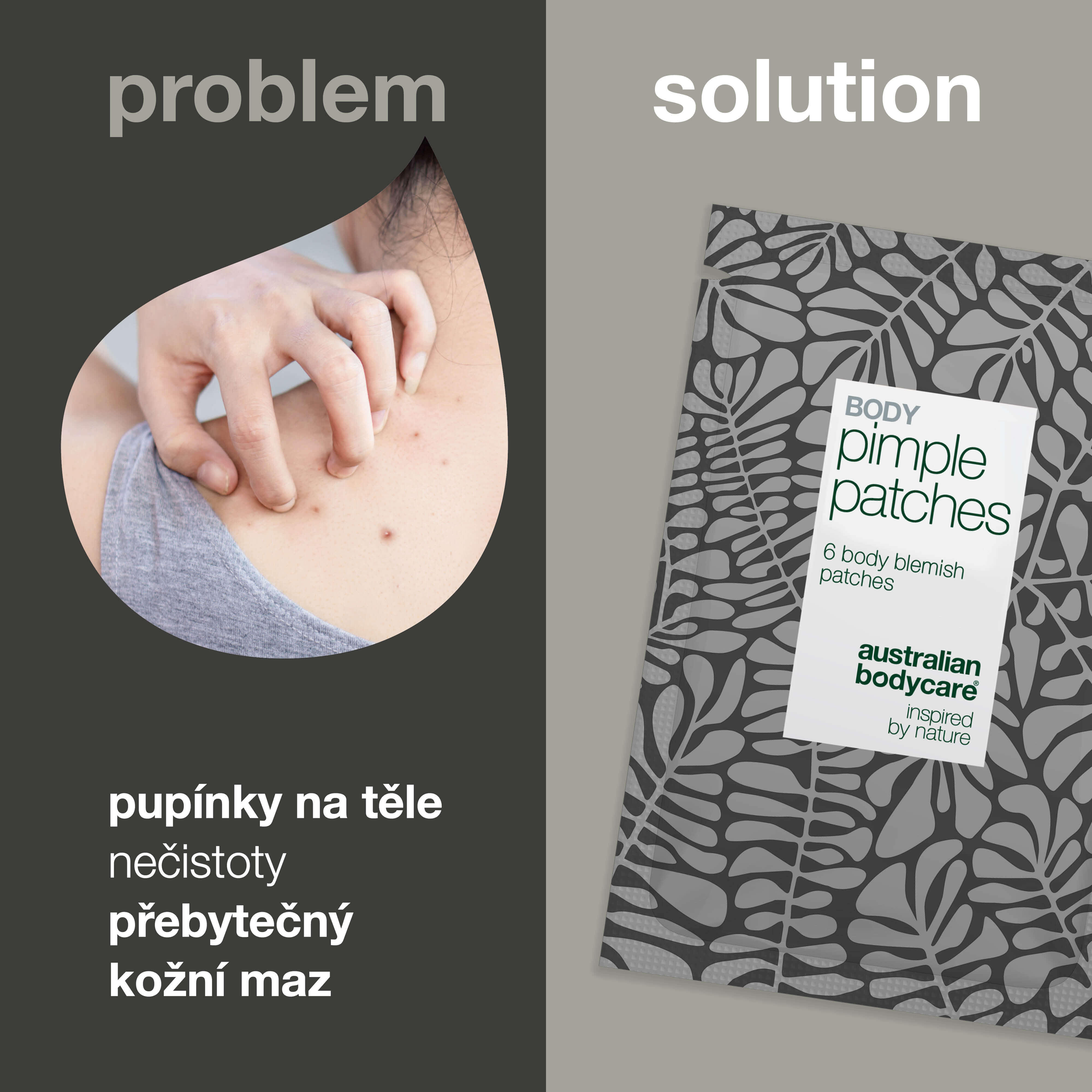 Body Pimple Patches – Náplasti na pupínky na tělo — Odstraňte pupínky na zádech, hrudi a ramenou. Náplasti absorbují maz a chrání pokožku před bakteriemi.