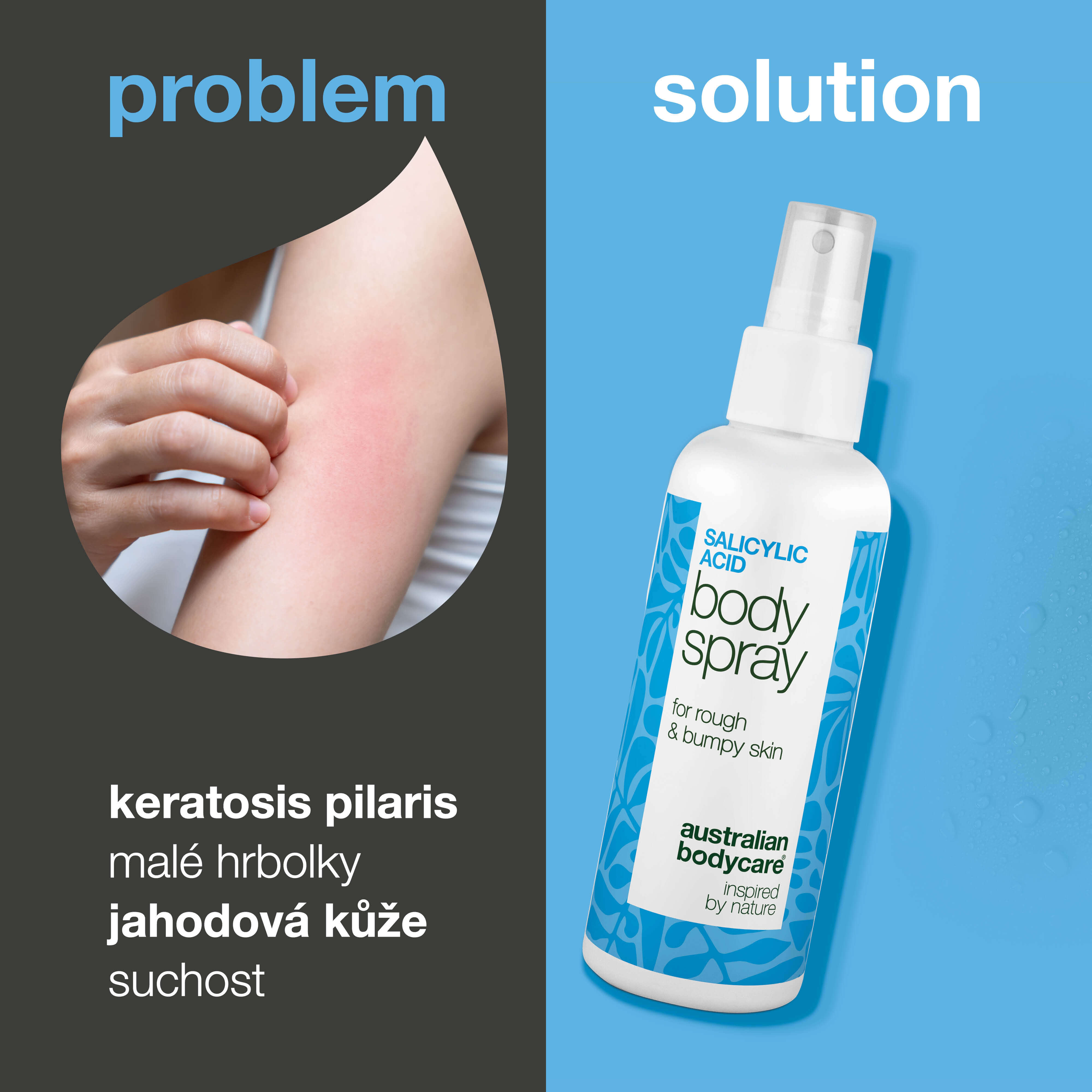 Sprej na keratosis pilaris, známou jako kuřecí kůže. Obsahuje kys. salicylovou, glykolovou, glycerin a panthenol pro jemnější a hydratovanou pokožku.