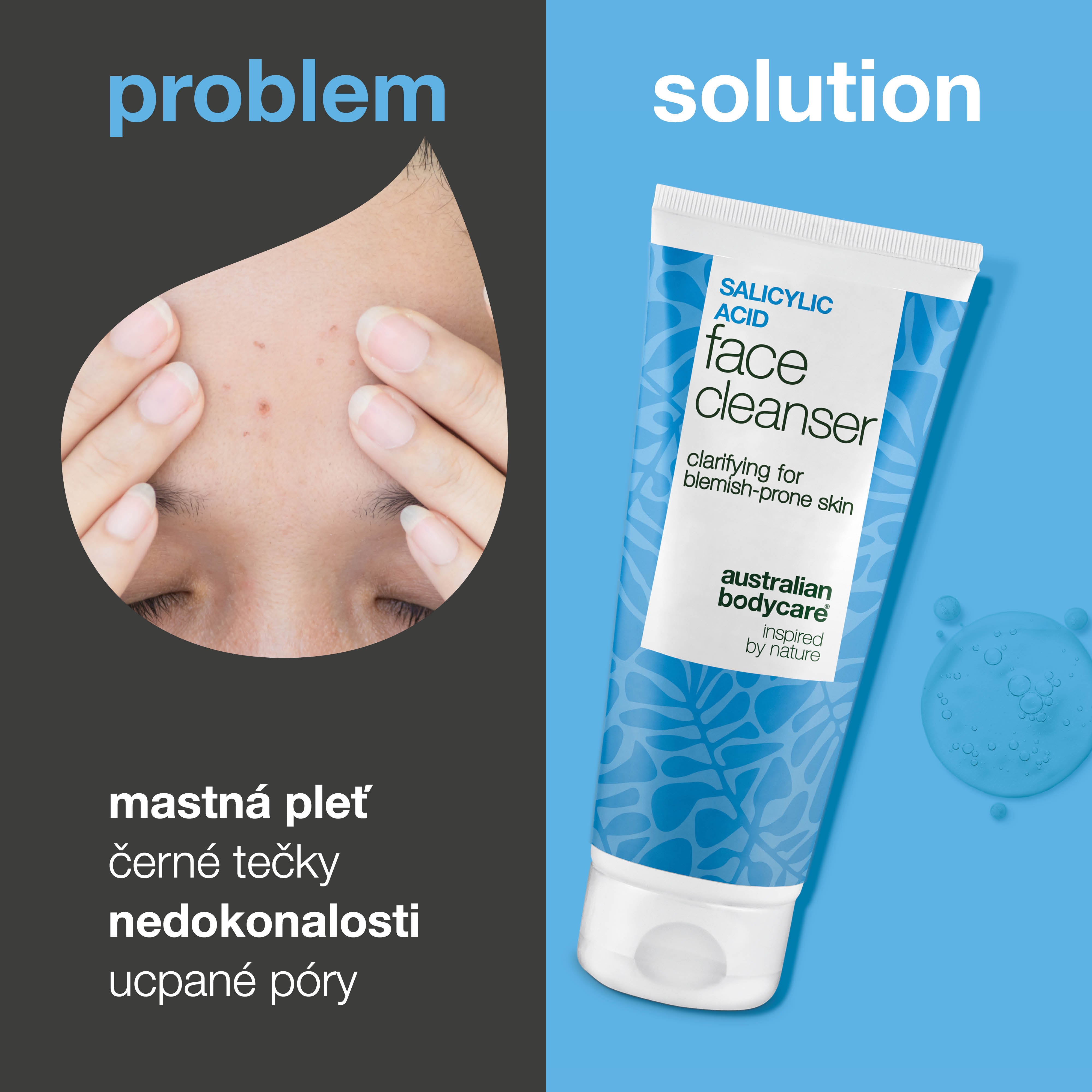 Čisticí gel s kyselinou salicylovou – čistí póry a snižuje pupínky, černé tečky a mastnotu