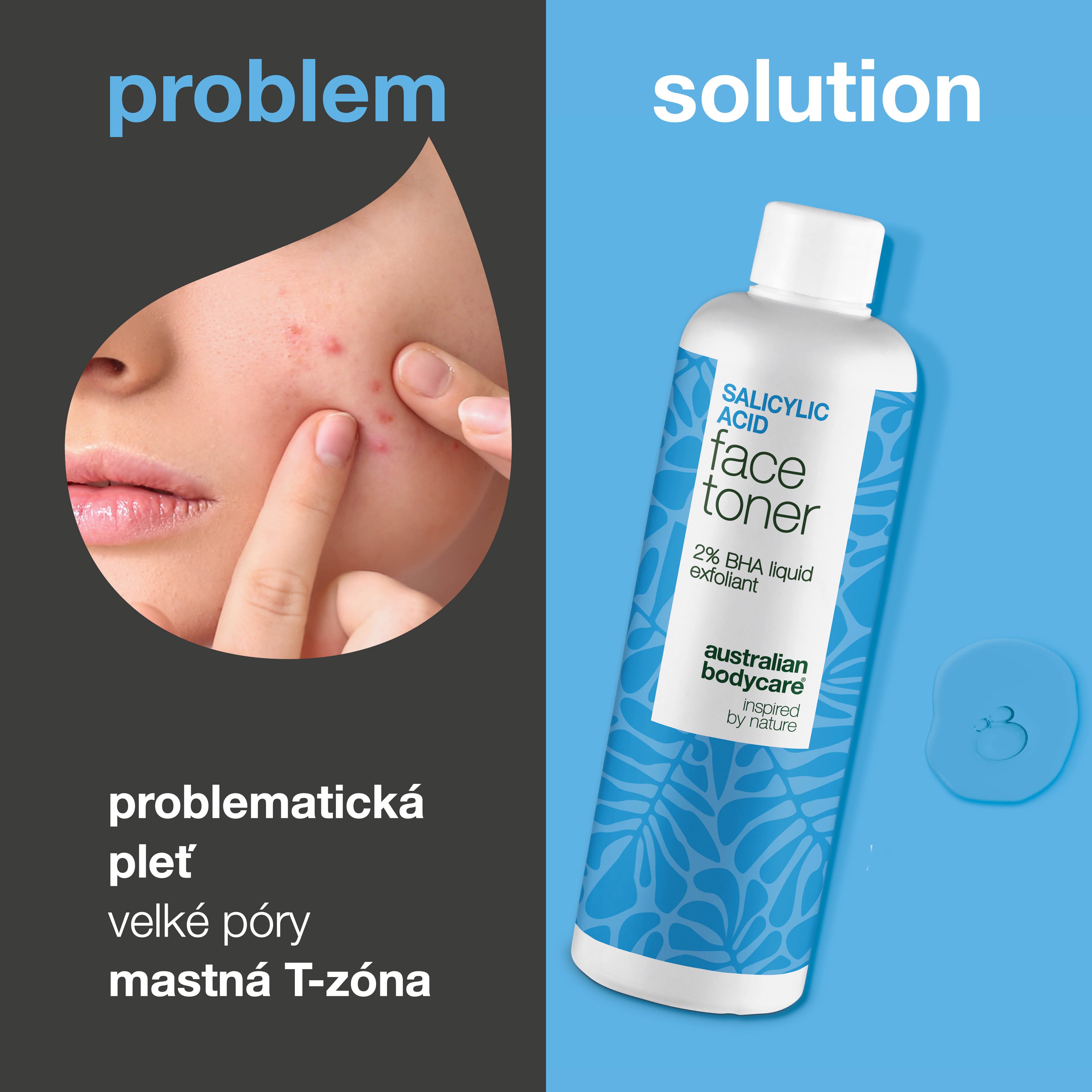Salicylic Acid toner pomáhá proti pupínkům, ucpaným pórům a nerovné struktuře pleti. Vhodný pro problematickou pleť. Salicylic Acid od Australian Bodycare.