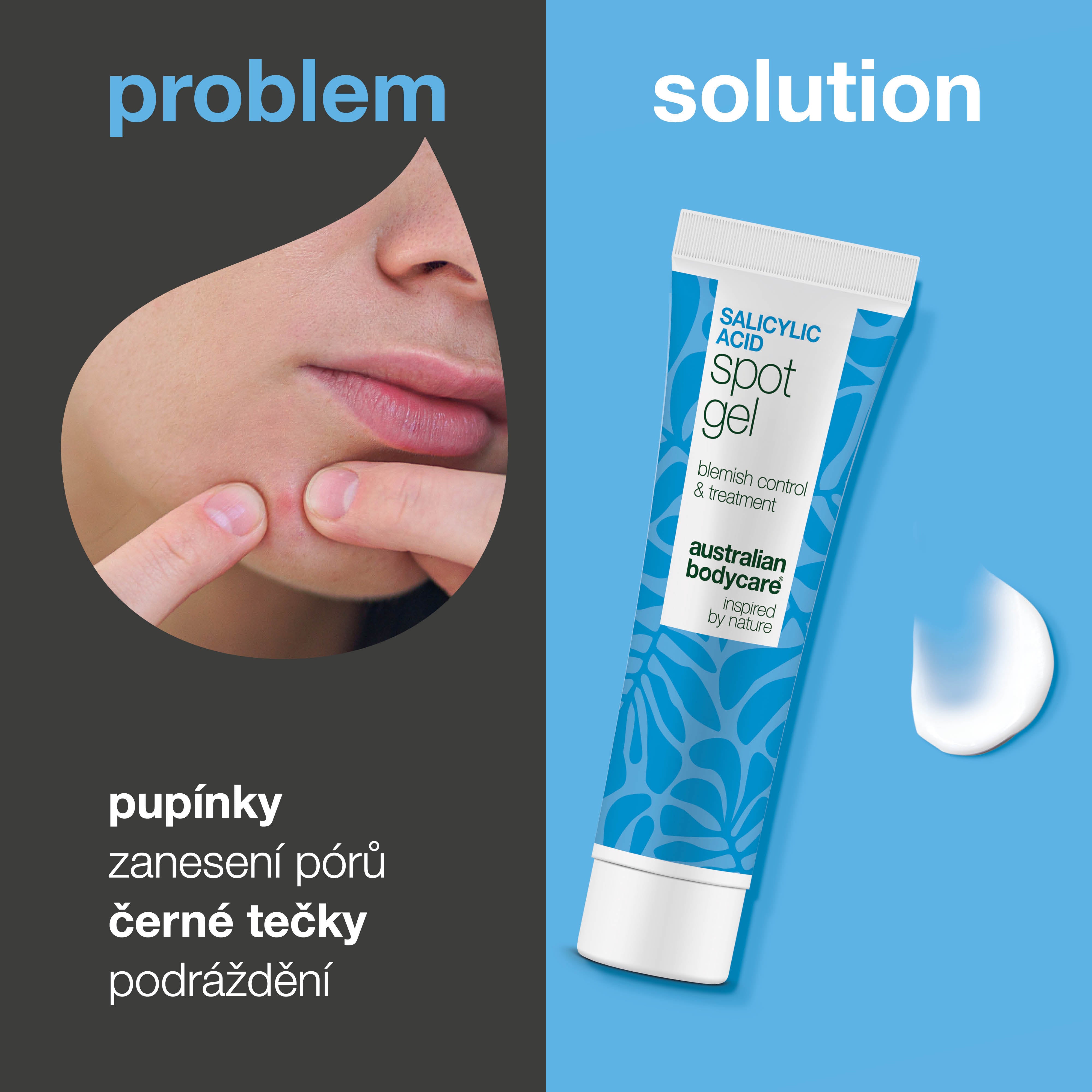 Spot gel s kyselinou salicylovou na pupínky, černé tečky a zarudnutí – čistí póry a zklidňuje pleť
