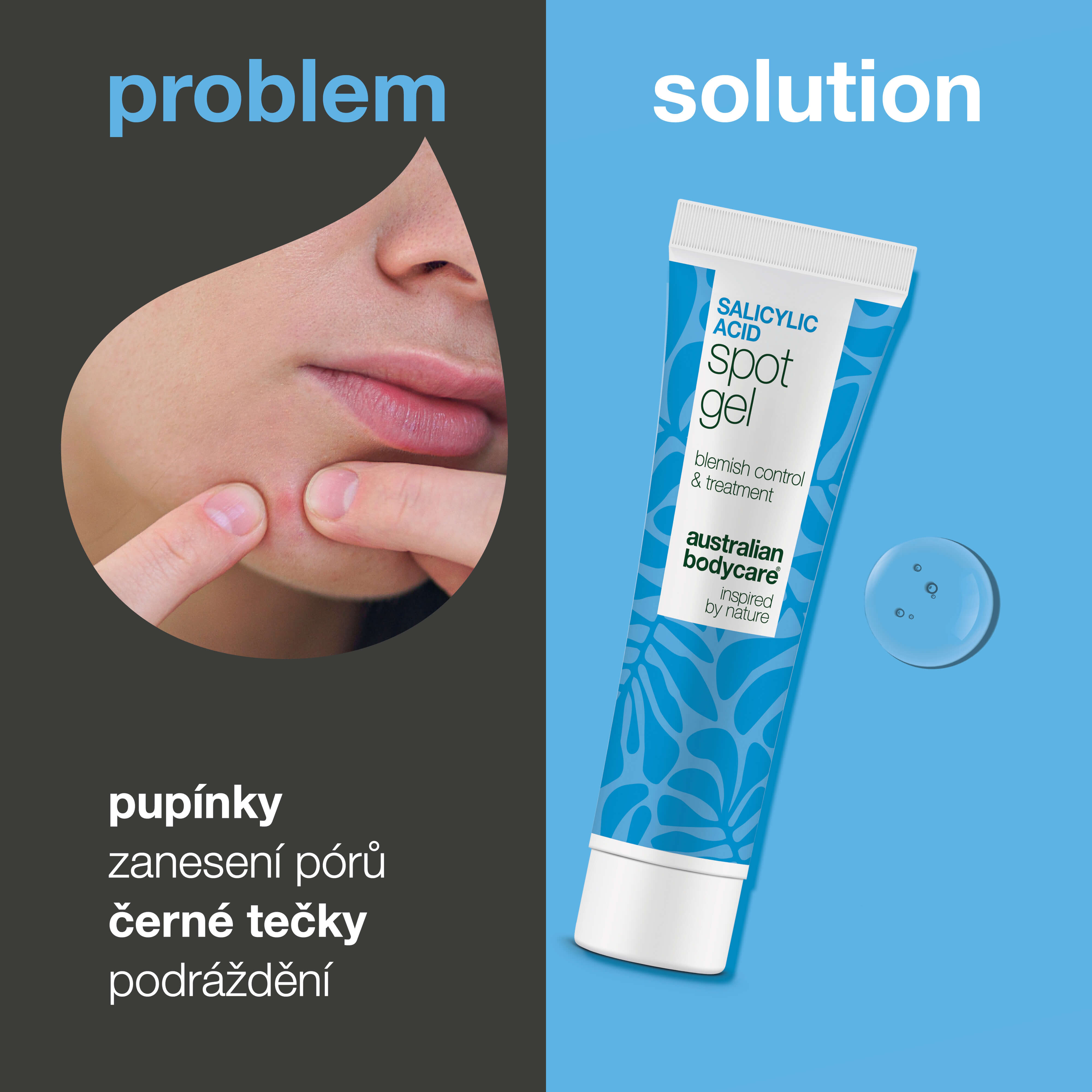 Gel s kyselinou salicylovou na pupínky a černé tečky — Spot Gel s kyselina salicylová odstraňuje maz a odumřelé buňky. Čistší, jemnější a vyvážená pleť díky kyselině salicylové.