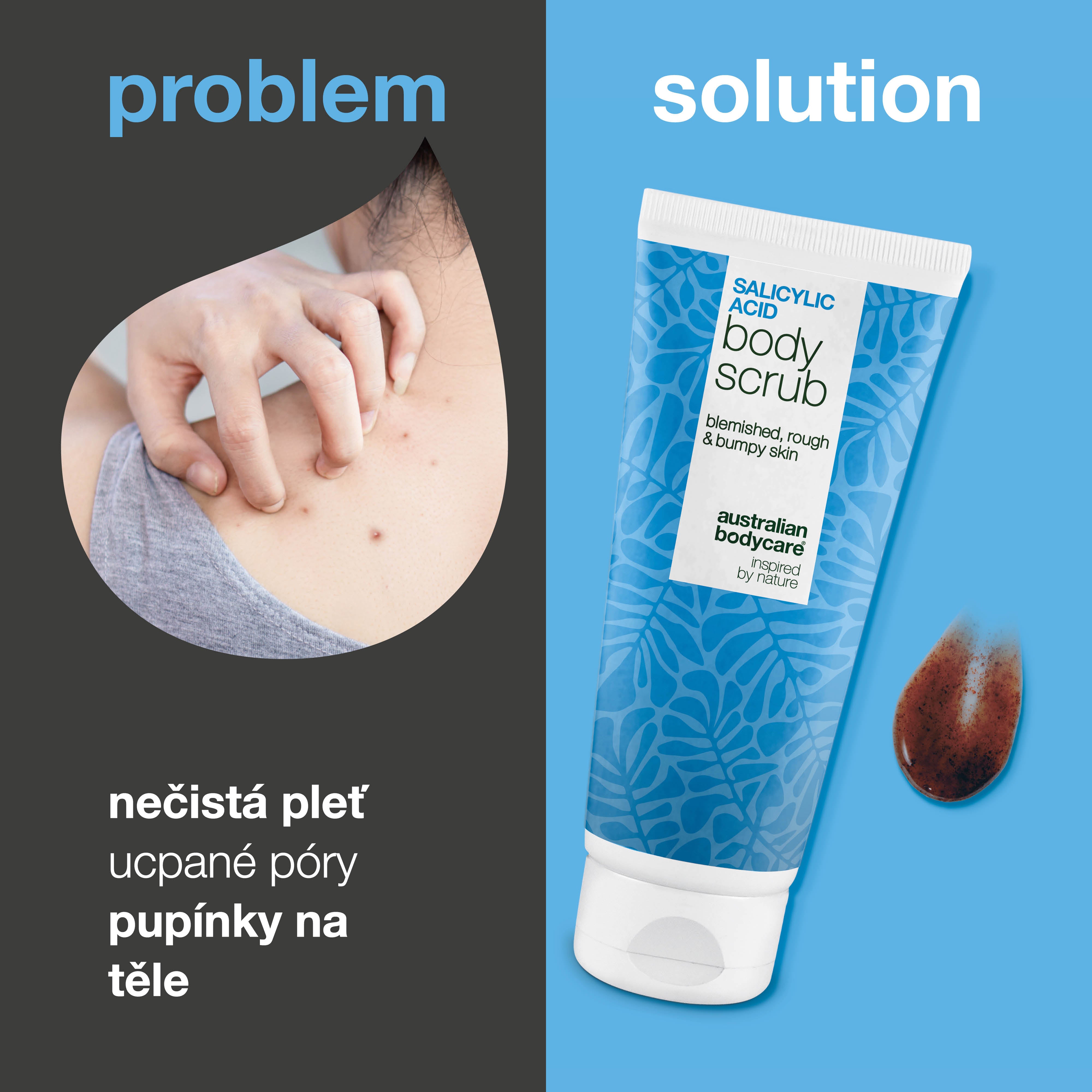 Tělový peeling s kyselinou salicylovou pro čistou a hladkou pokožku — Tělový peeling s kyselinou salicylovou čistí póry a odstraňuje nedokonalosti. S kyselinou salicylovou, glykolovou a allantoinem.