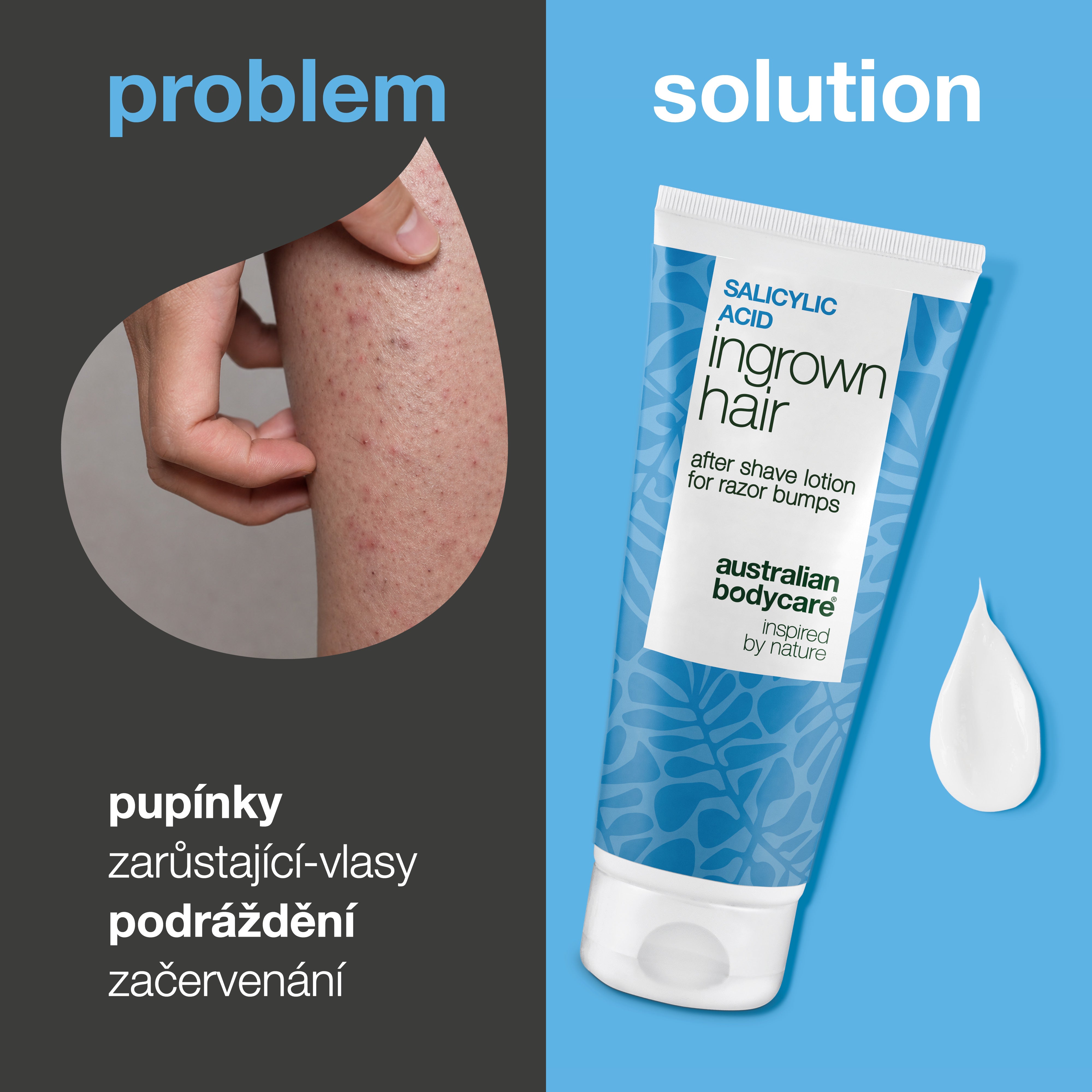 Pečující mléko po holení s kyselinou salicylovou proti zarůstajícím chloupkům, červeným pupínkům a podráždění po holení. Produkt je zobrazen vedle pokožky s viditelnými červenými pupínky a zarůstajícími chloupky.