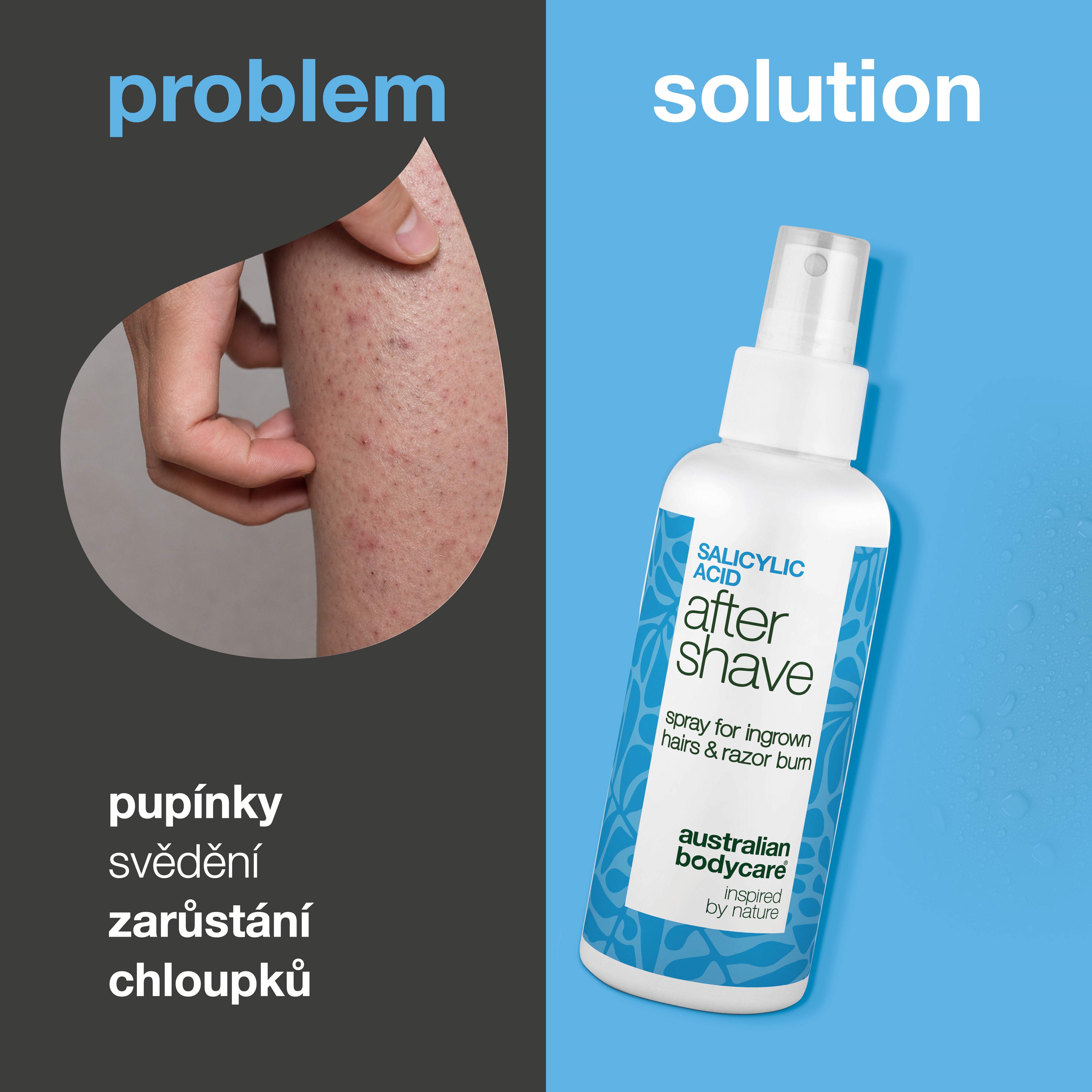 Sprej po holení s kyselinou salicylovou na pupínky — Sprej po holení na pupínky a zarůstající chloupky. Kyselina salicylová a Aloe Vera zklidní svědění pro hladkou pleť. Vyzkoušejte hned.