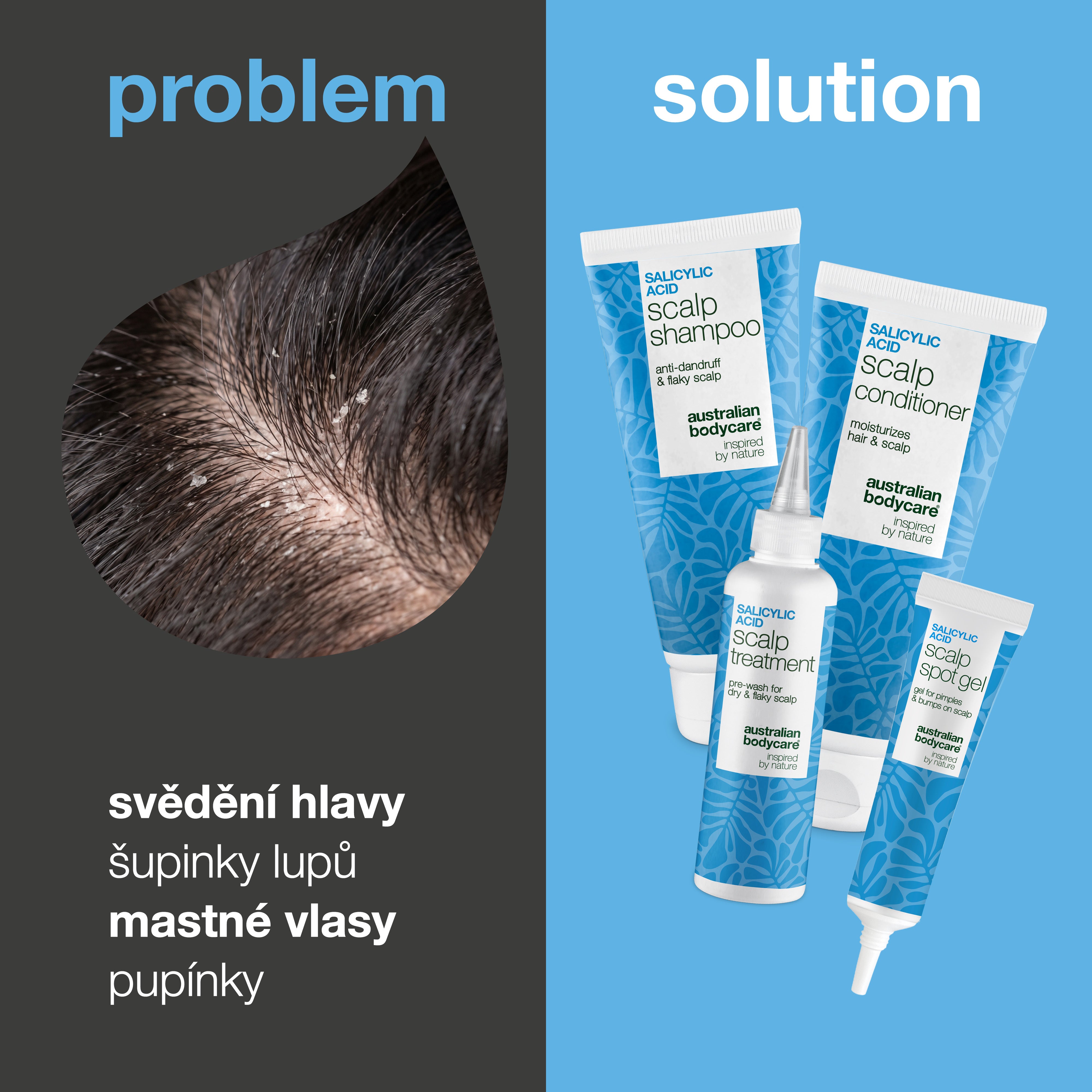 Problém a řešení: detail lupů ve vlasech vedle čtyř produktů sady proti svědění, lupům a pupínkům