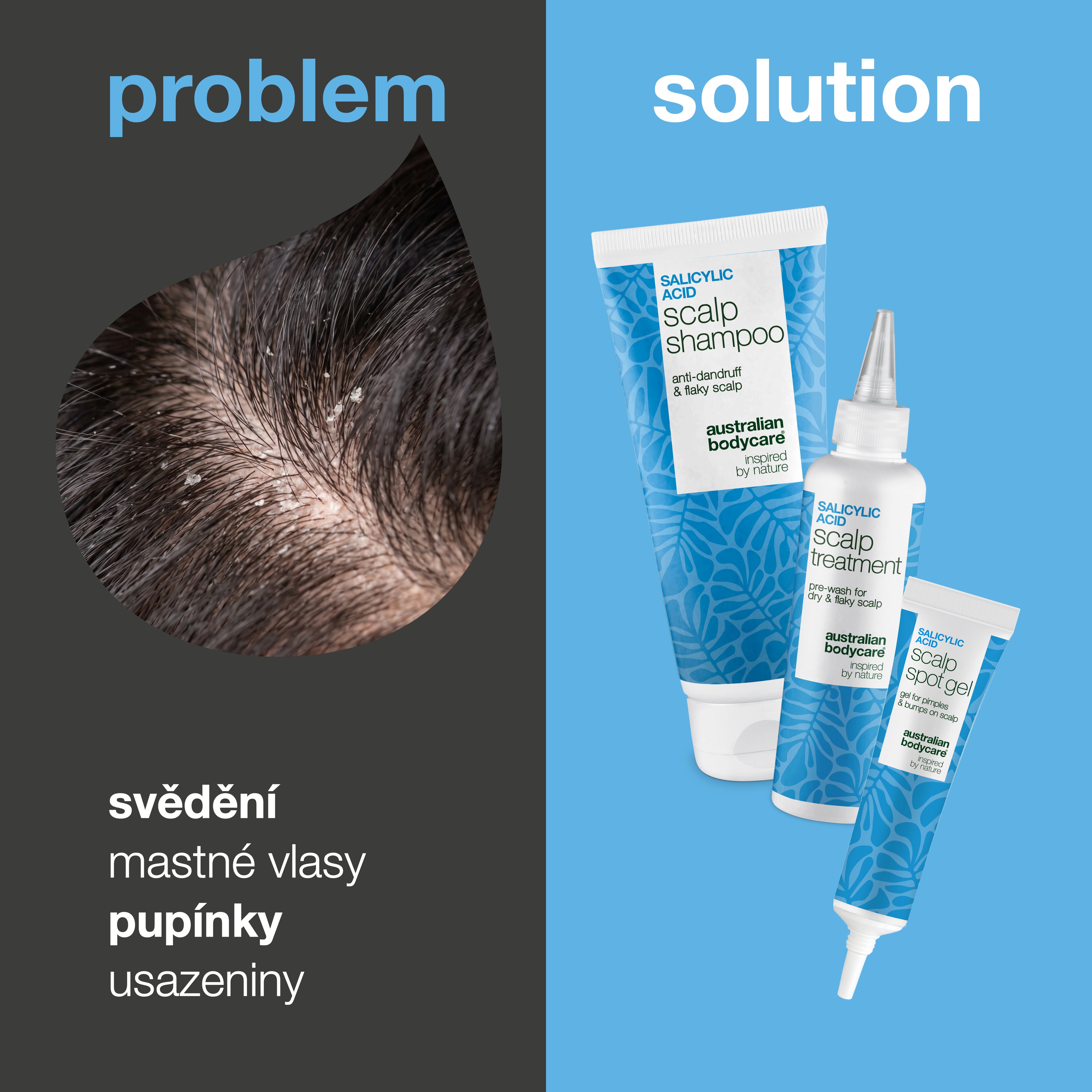 Problém a řešení: detail svědění, mastných vlasů a usazenin na pokožce hlavy vedle tří produktů sady