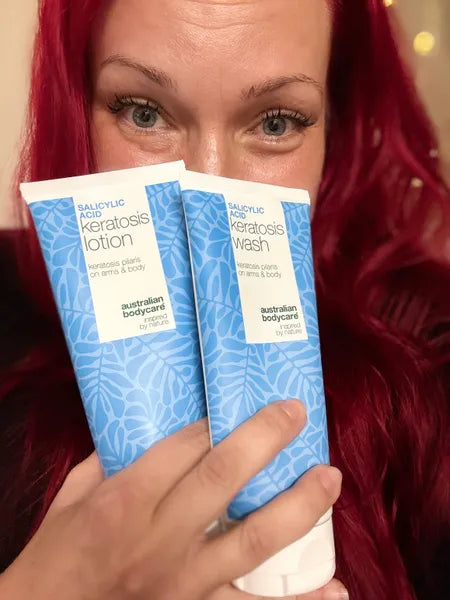 Výsledek zákazníka keratosis pilaris – Viktorija K.
