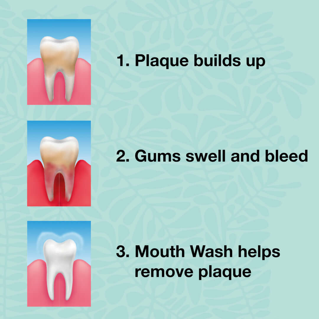 3 ks zubní pasty Tea Tree Oil Freshmint - Pro každodenní péči o parodontální onemocnění, plísně a zánět dásní