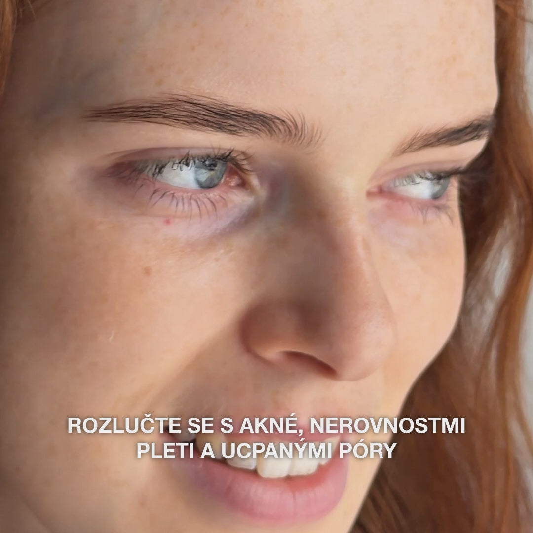 Sérum s kyselina salicylová na černé tečky a mastnou pleť — Sérum s kyselina salicylová na nečistou pleť a póry. Obsahuje Zinc PCA, zelený čaj, kyselinu hyaluronovou a glycerin.