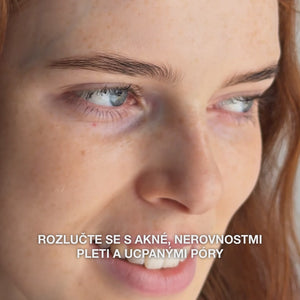 Sérum s kyselina salicylová na černé tečky a mastnou pleť — Sérum s kyselina salicylová na nečistou pleť a póry. Obsahuje Zinc PCA, zelený čaj, kyselinu hyaluronovou a glycerin.