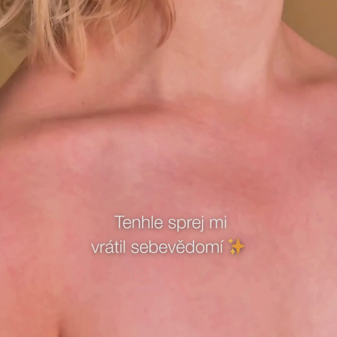 Žena používá tělový sprej s kyselinou salicylovou – před/po s méně akné a čistší pletí.