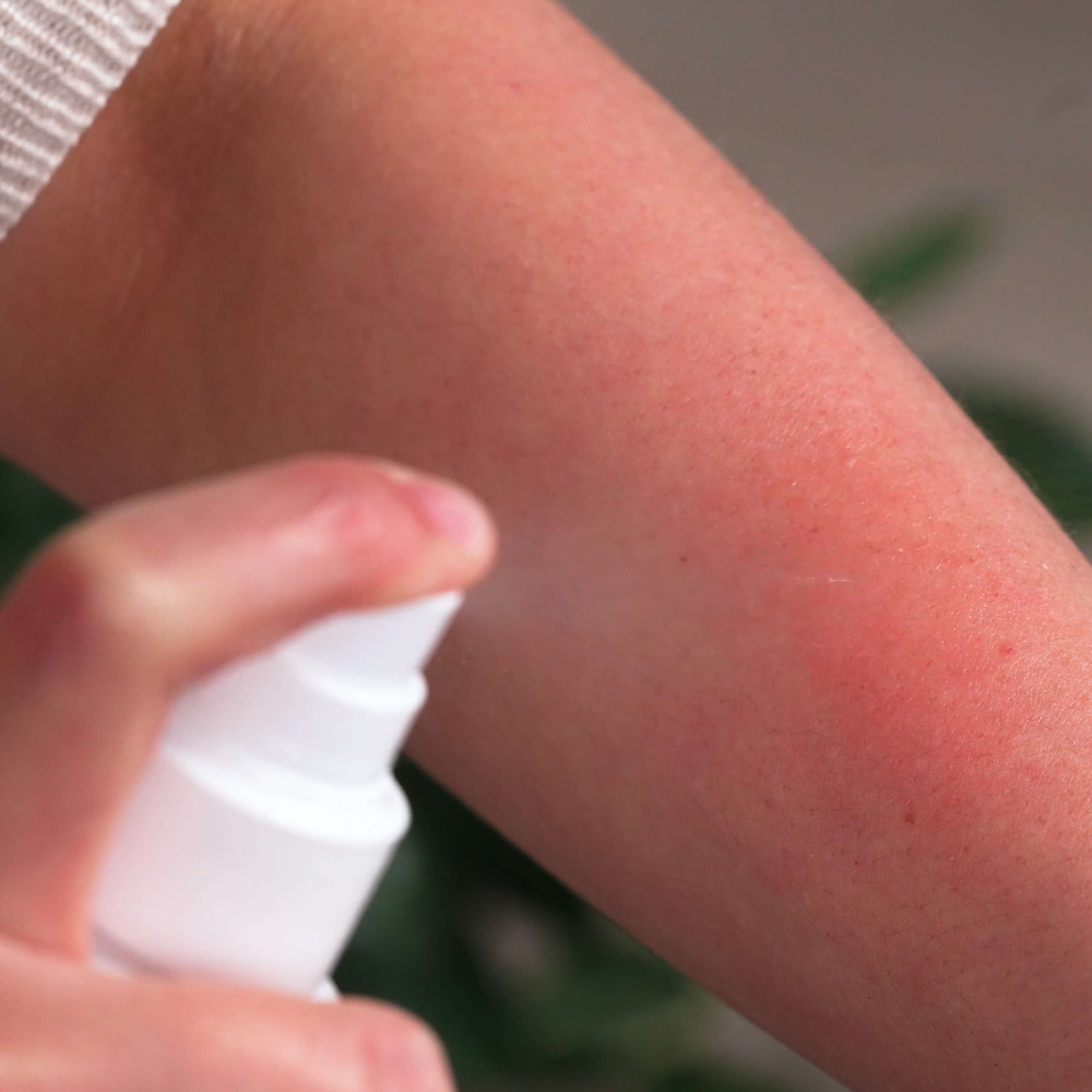 2-balení na svědění kůže a podrážděnou pokožku — Sada pro péči o podrážděnou pokožku na těle